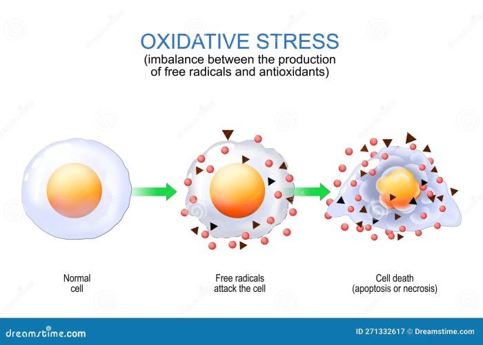 AntiOxidant Free Radicals | David Richardson, MD - Glaucoma, Cataract ...